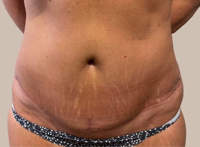 ME (900 x 300 px) - 97