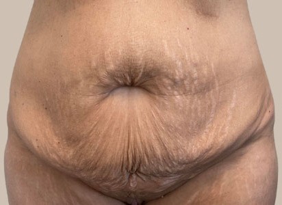 ME (900 x 300 px) - 97