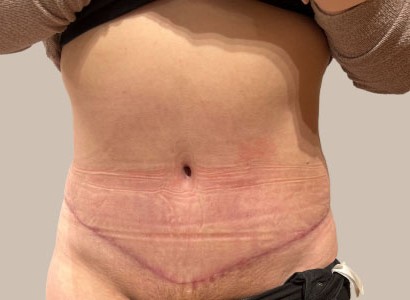 ME (900 x 300 px) - 97