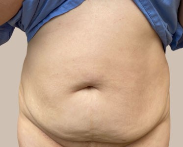 ME (900 x 300 px) - 97