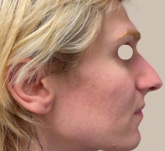 ME (900 x 300 px) - 99