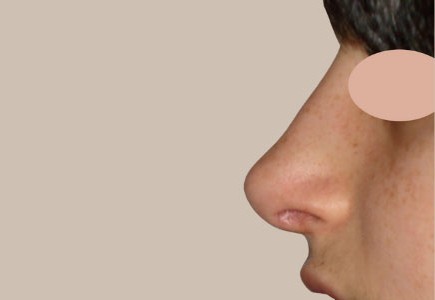 ME (900 x 300 px) - 99