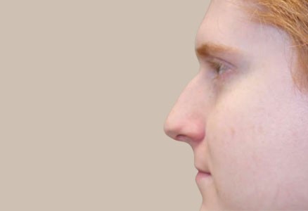 ME (900 x 300 px) - 99