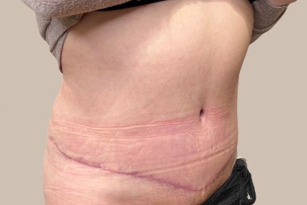 ME (900 x 300 px) - 97